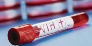 Científicos logran eliminar el VIH de células infectadas