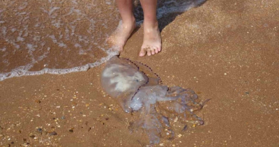 Atiende CR a 8 bañistas por quemaduras de medusas