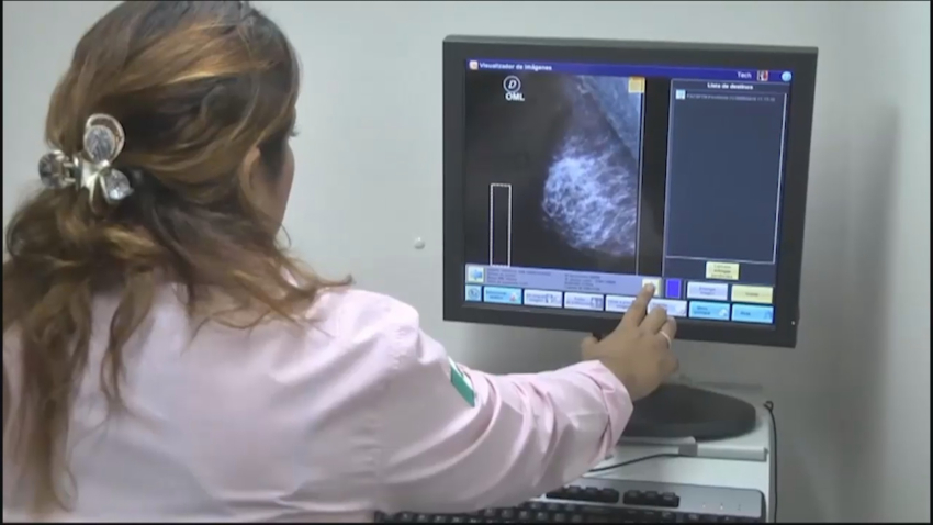 VIDEO Autoridades de Salud piden a mujeres hacerse revisiones para prevenir cáncer de mama