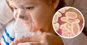 Confirman cuatro casos de tosferina