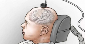 Implante cerebral de Facebook regresaría el “habla” a personas con parálisis
